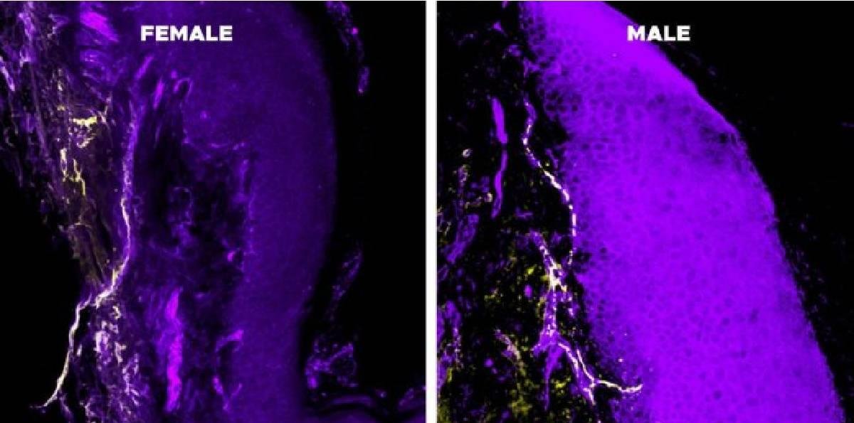 El sistema inmunitario, la causa de que el dolor crónico dure más en las mujeres