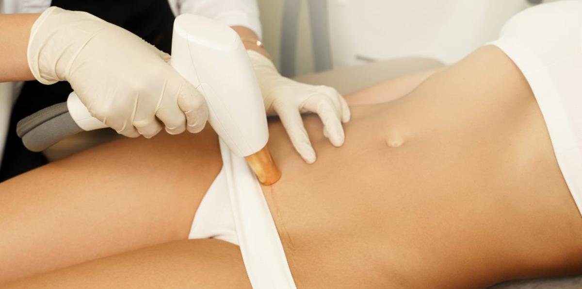 Bulgaria: Sesiones de depilación íntima de 100 mujeres se publicaron en sitios porno