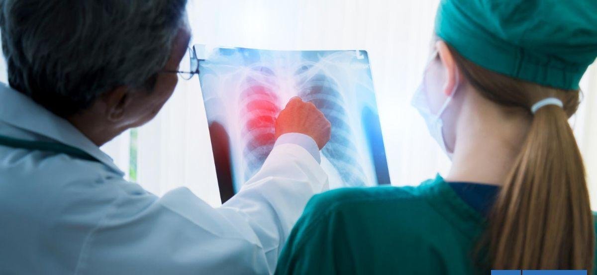 5 síntomas que podrían indicar que sufres una embolia pulmonar: causa de muerte de Catherine O’Hara