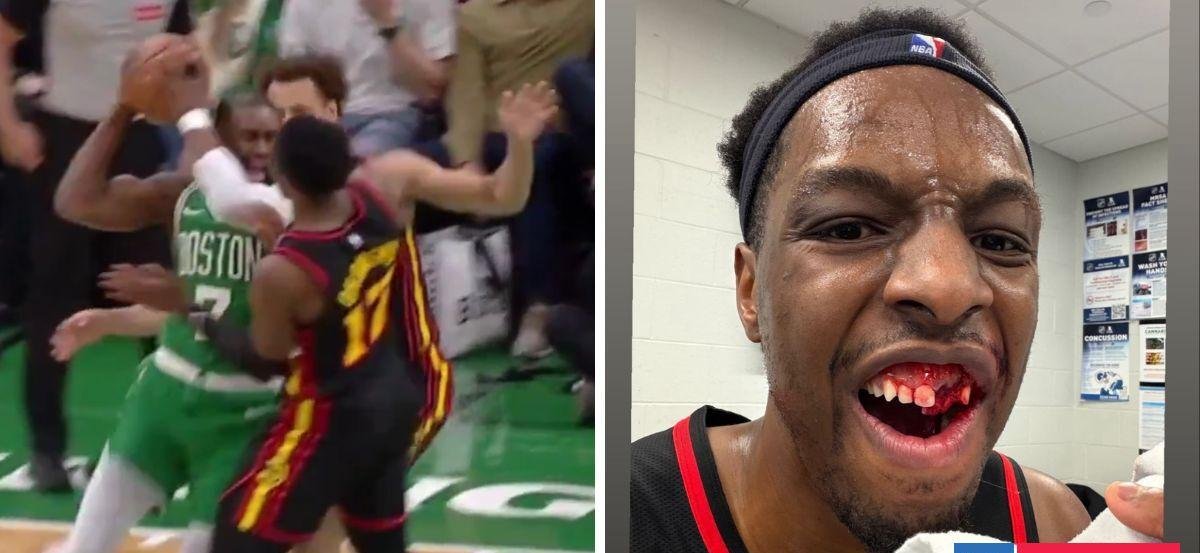 El fuerte codazo que recibió Onyeka Okongwu y que le dejó dos dientes sueltos en victoria ante Celtics