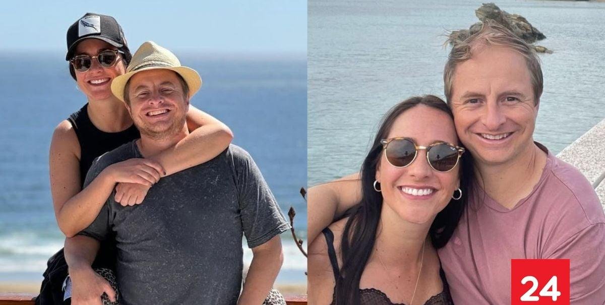 A un año de su implante capilar: el impresionante cambio de Coke Hevia