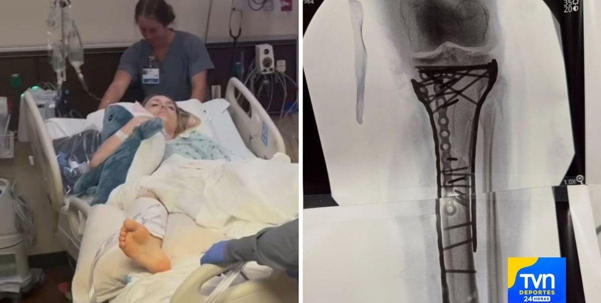 "El dolor ha sido difícil de controlar (...) he tenido algunos problemas postoperatorios"