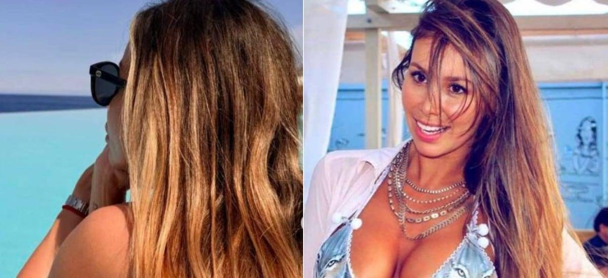 Tras calvario que enfrentó: así luce el rostro de Romina Zalazar a un año de intervención para corregir fallida cirugía