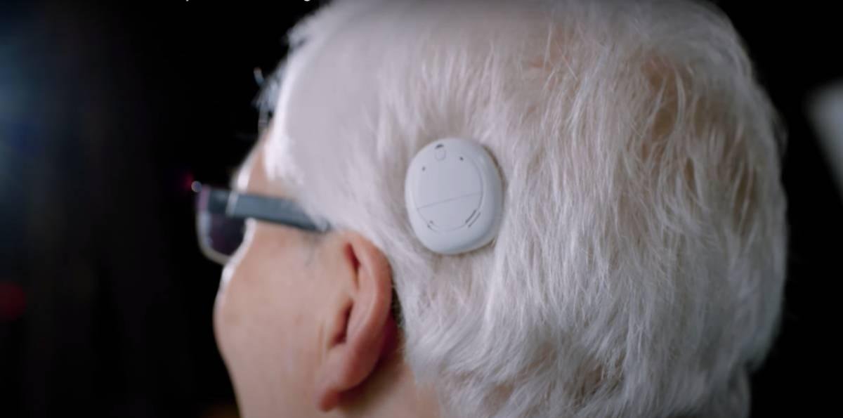 [Audio] Día del Implante Coclear: La importancia de una detección temprana de la pérdida auditiva