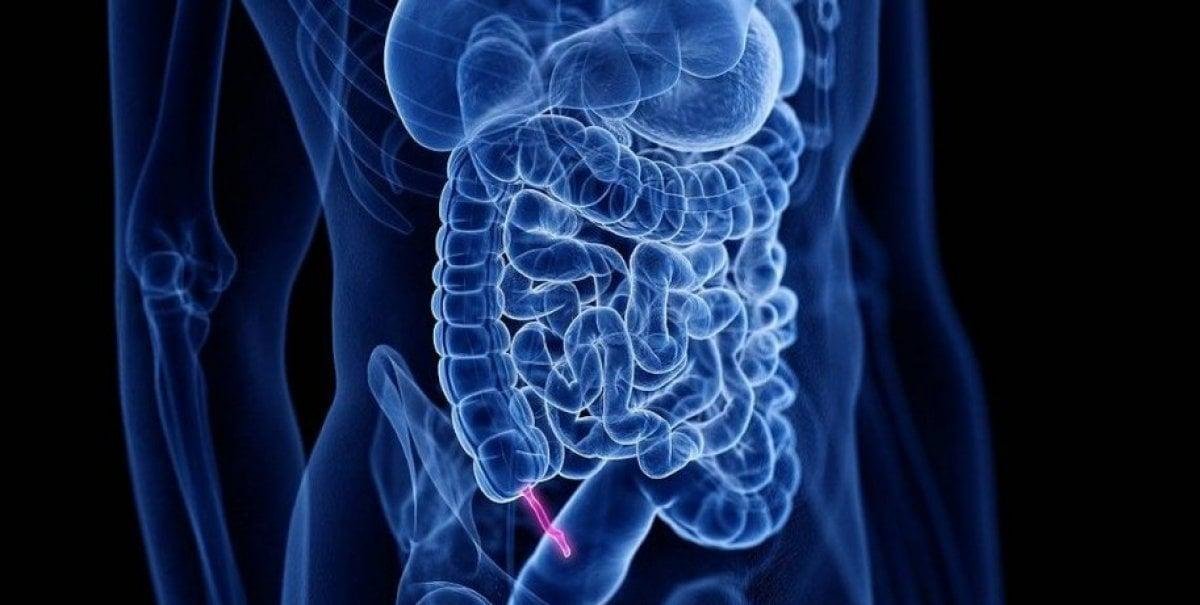 Por qué el apéndice no es tan inútil como se pensó durante décadas