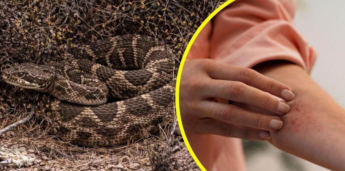 ¿Qué pasa si me muerde una serpiente cascabel? Los riesgos ante el ataque del reptil que fue avistado en San Antonio