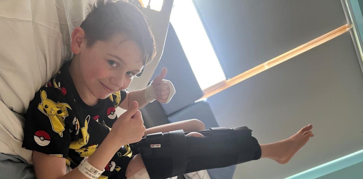 Cirugía pionera en el Reino Unido: imanes y un clavo interno corrigieron malformación ósea en un niño