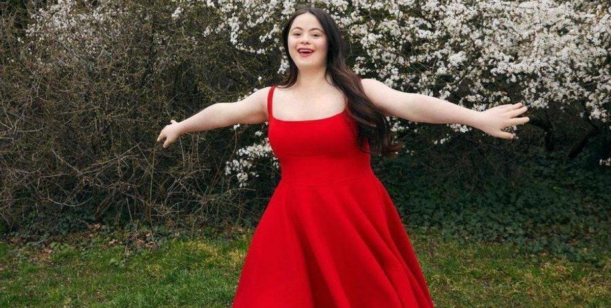 Los doctores le dijeron que nunca caminaría ni hablaría y ahora es una modelo de Vogue