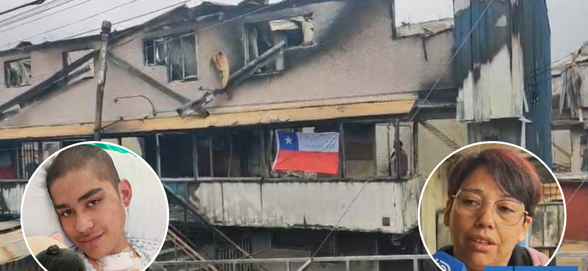 Familia de joven en rehabilitación por grave atropello perdió su hogar en incendio de Lirquén