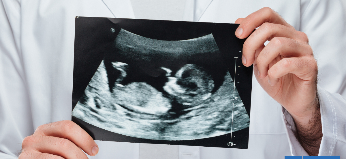 Estudio sugiere que los fetos que bostezan más podrían nacer con menos peso