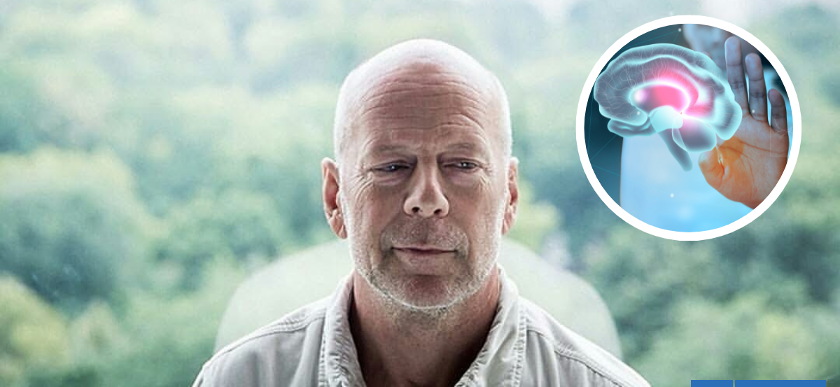 ¿Qué es la anosognosia? Condición que padece Bruce Willis y que fue revelada por su esposa