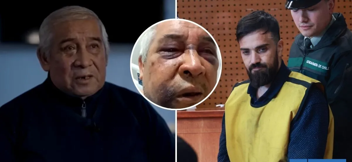 "Pésimas condiciones": abogada actualiza estado de salud de conserje golpeado por Martín de Los Santos